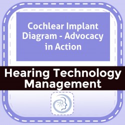 Cochlear Implant Diagram - Advocacy in Action